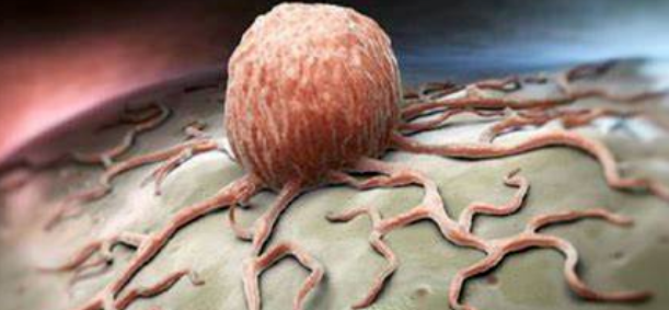 图片5.png 图片5.png